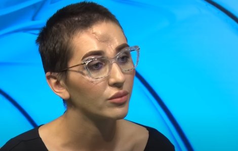Dana Roba, mărturisiri cutremurătoare. Make-up artista, din nou pe masa de operație: „Nu mai am miros și gust”