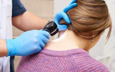 5 leziuni comune ale pielii -...