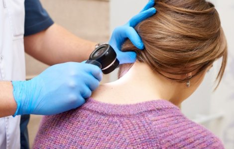 5 leziuni comune ale pielii - cum le identifici și ce semnificație au