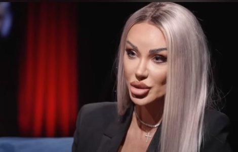 Bianca Drăgușanu vrea să își topească acidul din buze. De ce a luat decizia: „Este ceva foarte rău”