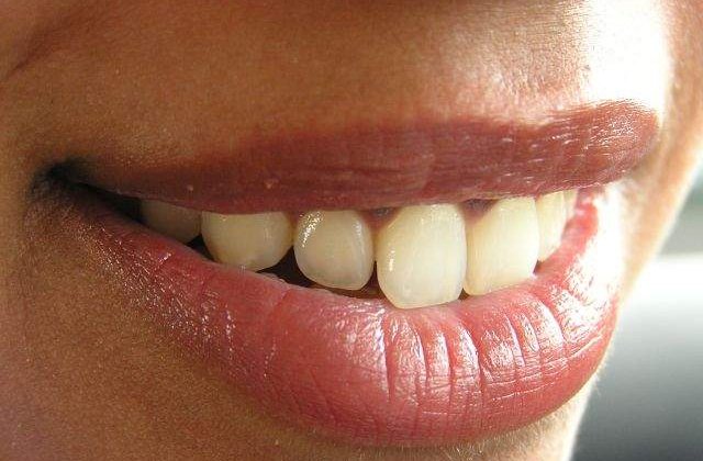 Le consumi ZILNIC! TOP 10 Cele mai PERICULOASE alimente pentru dantura