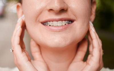 Aparatul dentar: secretul...