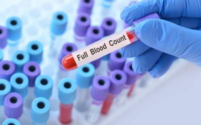 Ce este hemoleucograma...