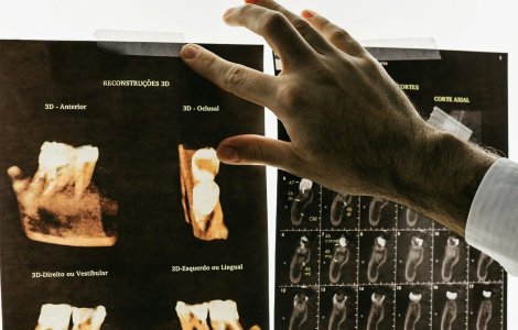 Cât de sigură este radiologia dentară și când se recomandă?