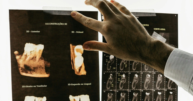 Cât de sigură este radiologia dentară și când se recomandă?