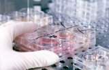 SIDA: Accesul tot mai mare la antiretrovirale a diminuat virulenta HIV
