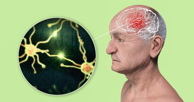 Descoperire care ar putea schimba totul: diagnosticarea Alzheimer prin sânge!