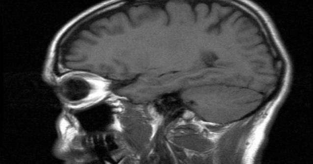 Mecanismul cerebral care controleaza nevoia de glucoza, descoperit