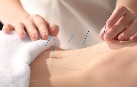 Descoperă cum acupunctura poate fi soluția neașteptată pentru infertilitate