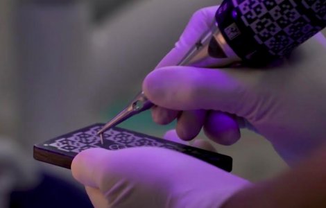 Descoperă secretul implanturilor dentare fără durere și fără tăietură: inovația X-Guide de la Nobel Biocare
