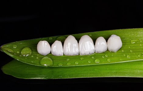 Descoperă cum fațetele dentare îți transformă zâmbetul și încrederea!