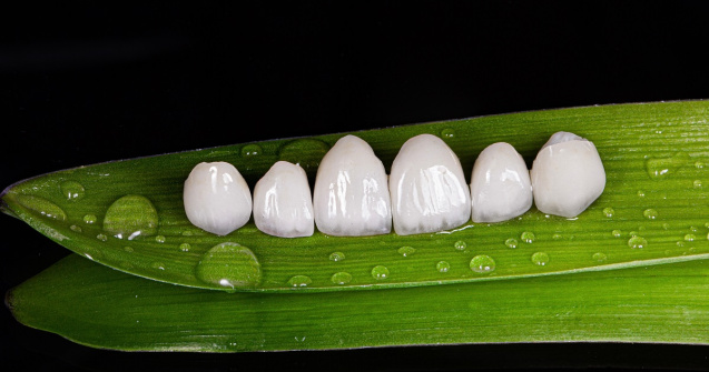 Descoperă cum fațetele dentare îți transformă zâmbetul și încrederea!