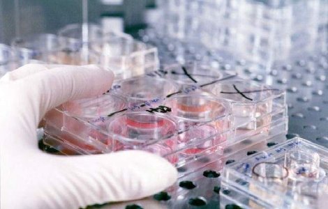 CANCERUL, prevenit printr-un stil de viata sanatos