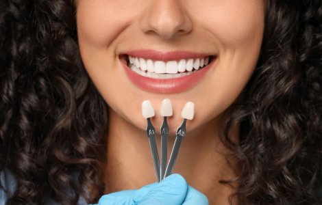 Ce sunt fațetele dentare și cum pot îmbunătăți aspectul zâmbetului tău?