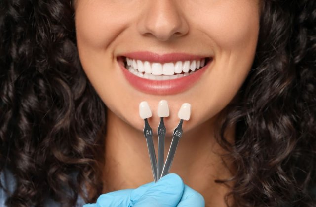 Ce sunt fațetele dentare și cum pot &icirc;mbunătăți aspectul z&acirc;mbetului tău?