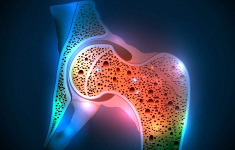 Descoperă alimentele care pot preveni osteoporoza și pe cele de evitat