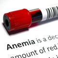 Simptomele anemiei - Cum se manifestă și când să mergi la medic