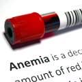 Simptomele anemiei - Cum se manifestă și când să mergi la medic