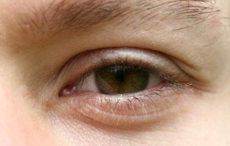  Top  10 lucruri pe care NU LE STIAI despre oamenii cu ochii CAPRUI