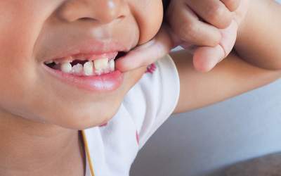 De ce dinții strâmbi ar putea...