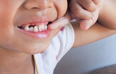 De ce dinții strâmbi ar putea avea un impact neașteptat asupra sănătății tale? Află ce spune Dr. Raluca Athanasiu despre efectele lor ascunse.