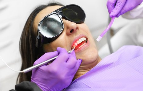 Cum laserul revoluționează stomatologia pentru confort maxim