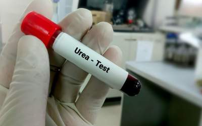 Descoperă alimentele care îți...