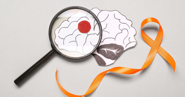 Descoperire medicală: Terapia cu celule stem pentru scleroza multiplă