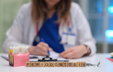 Dezvăluirea alarmantă: De ce femeile sub 40 de ani sunt tot mai afectate de boala parodontală?