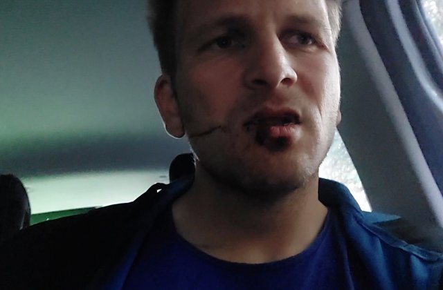 După Cioate&rdquo;: documentarul despre un atac nerezolvat și tăcerea unui sistem, din 28 noiembrie &icirc;n cinematografe