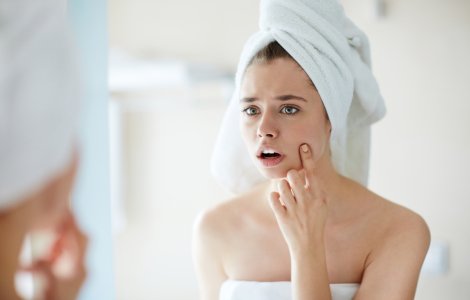 De ce nu e bine să storci coșurile? 9 motive pe care ar trebui să le iei în serios