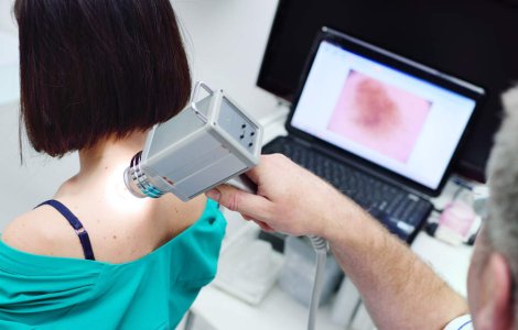 Verucile și negii: ce sunt, de ce apar, cum se tratează și când trebuie să mergi la medic