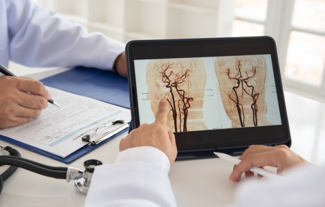 Ce afecțiuni poate depista angiografia cerebrală?