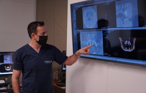 Primele implanturi Neodent ZiR, inserate cu succes prin ghidaj digital