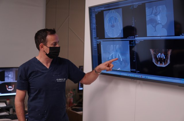 Premieră la Clinica 32. Primele implanturi Neodent ZiR, inserate cu succes prin ghidaj digital, fără tăieturi