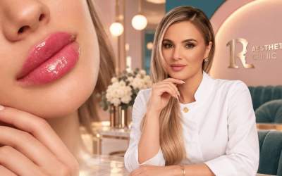 Russian Lips vs. buze clasice...