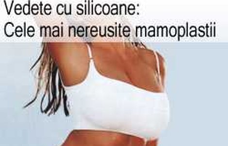 Vedete cu silicoane: Cele mai nereusite mamoplastii