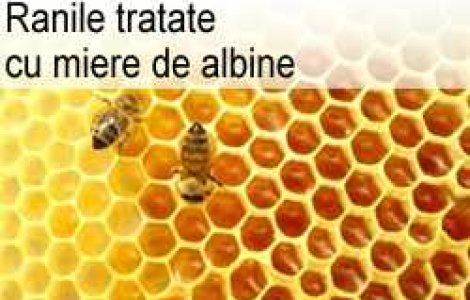 Ranile tratate cu miere de albine