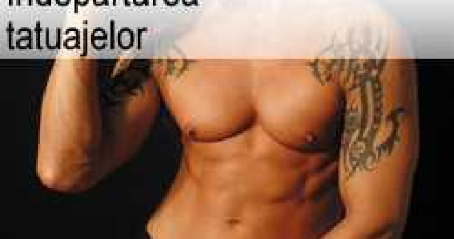 Indepartarea tatuajelor