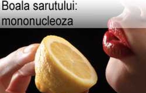 Boala sarutului: mononucleoza