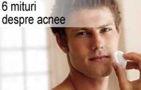 6 mituri despre acnee
