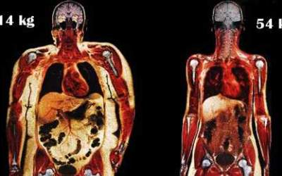 Corpuri scanate: O femeie de...