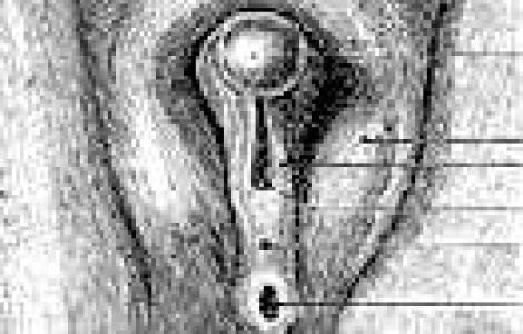 Stiati...cum se face transplantul de sex?