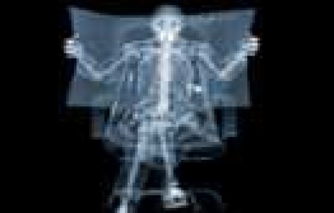  Top  Poze incredibile realizate cu Razele X