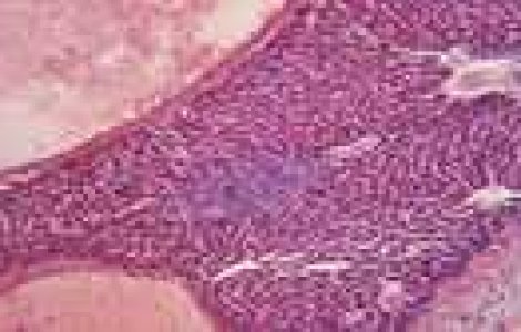 Cand vom scapa de cancer?