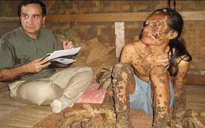 TOP 7 Cazuri medicale fascinante