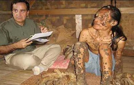 TOP 7 Cazuri medicale fascinante