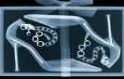 Bradul de Craciun in varianta Raze X