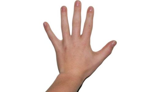  Top  Sunt un barometru al sanatatii! Ce BOLI pot fi tradate de aspectul UNGHIILOR