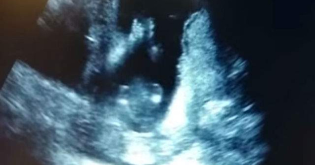  Video  Un bebelus bate din palme in pantece in timp ce mama ii canta